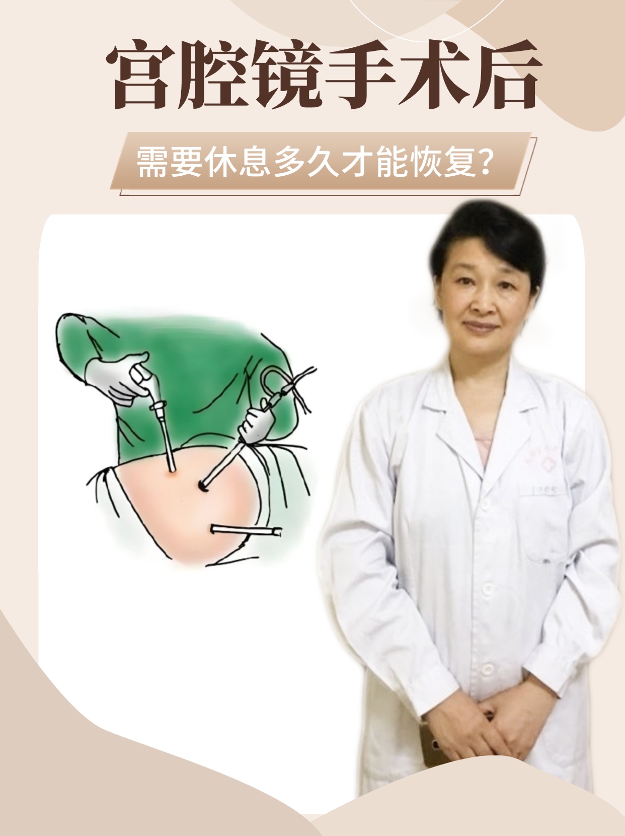微创妇科(微创妇科医院)