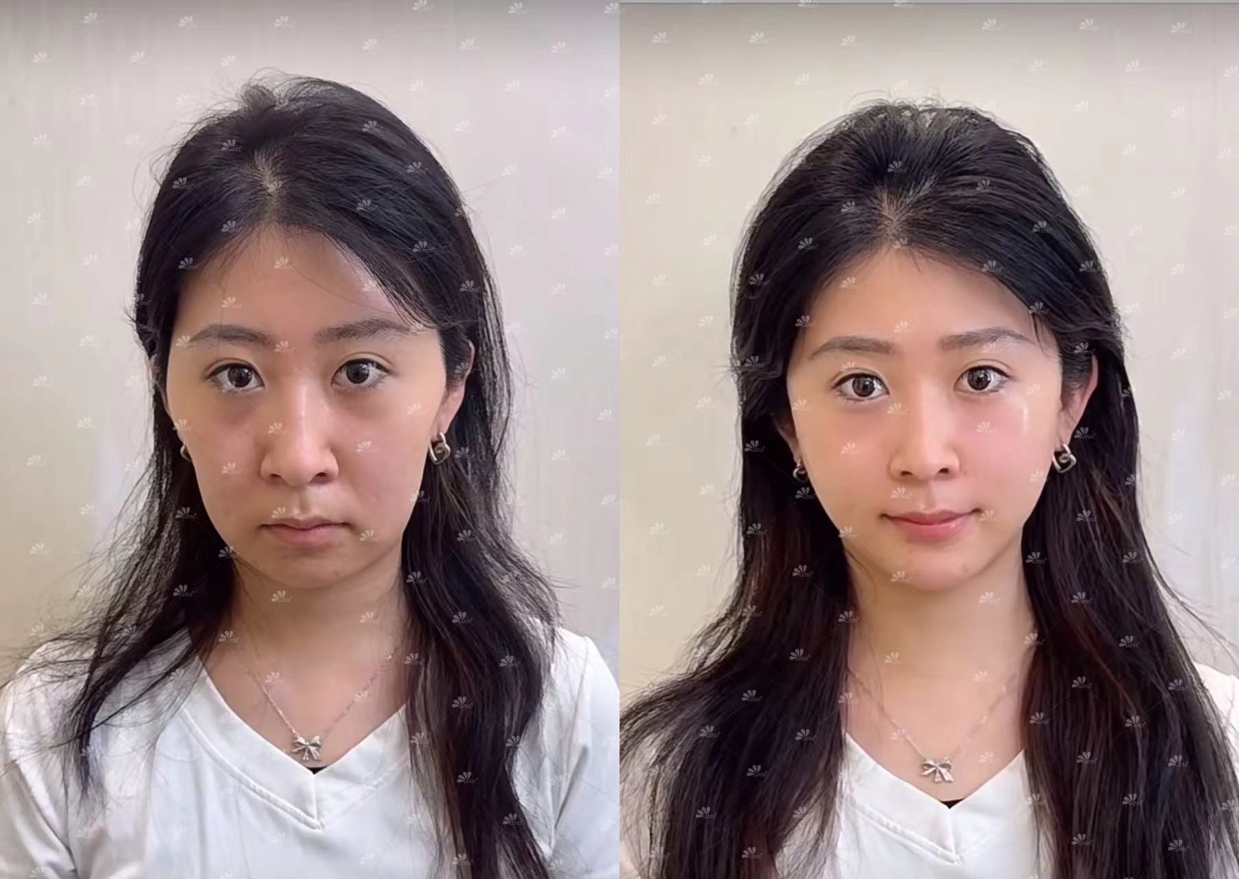 韩美整形(韩美整形美容医院是正规医院吗)