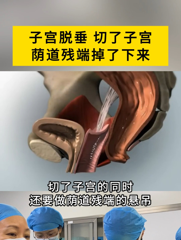 切除子宫(切除子宫还可以进行性生活吗)