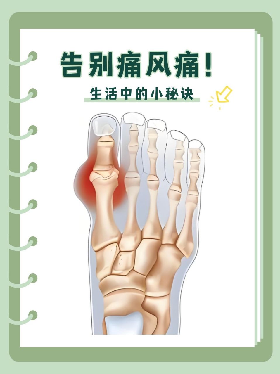 痛风(痛风的症状及治疗方法)