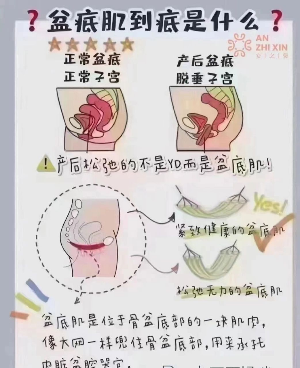 膨宫-膨宫管图片