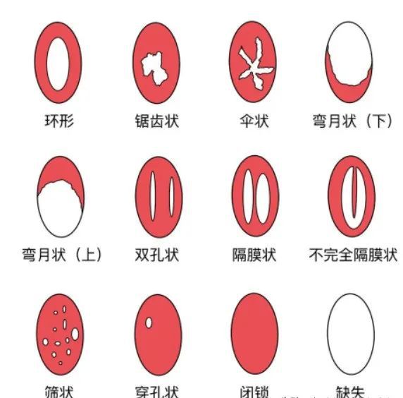 阴道性不孕(不孕不育阴性说明什么意思)