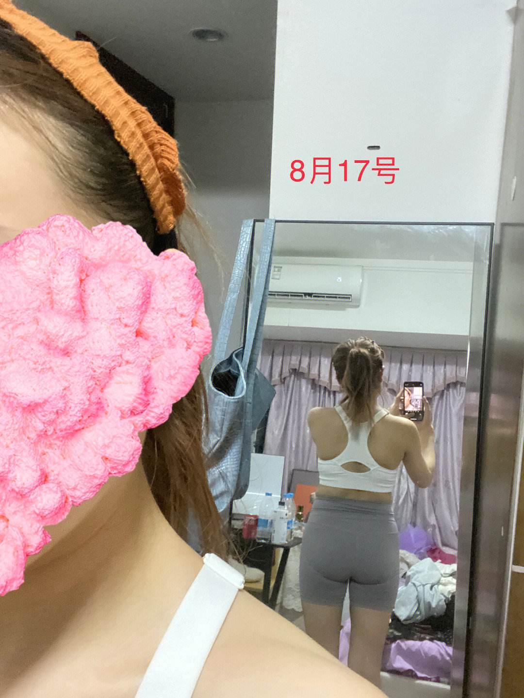 臀部吸脂-臀部吸脂有害吗