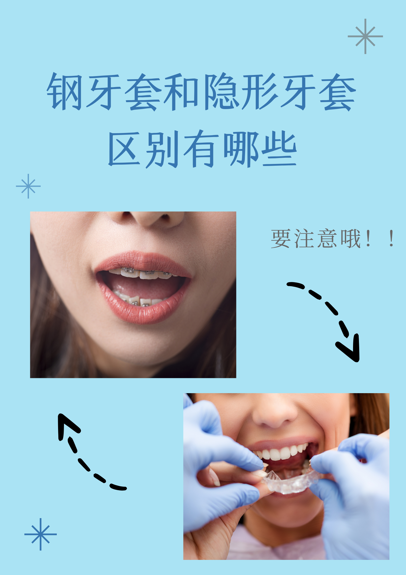 隐形牙齿矫正(隐形牙齿矫正器图片)