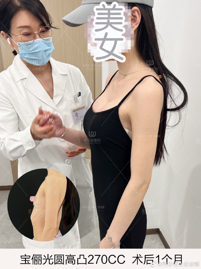 上海隆胸-上海隆胸专家前十名