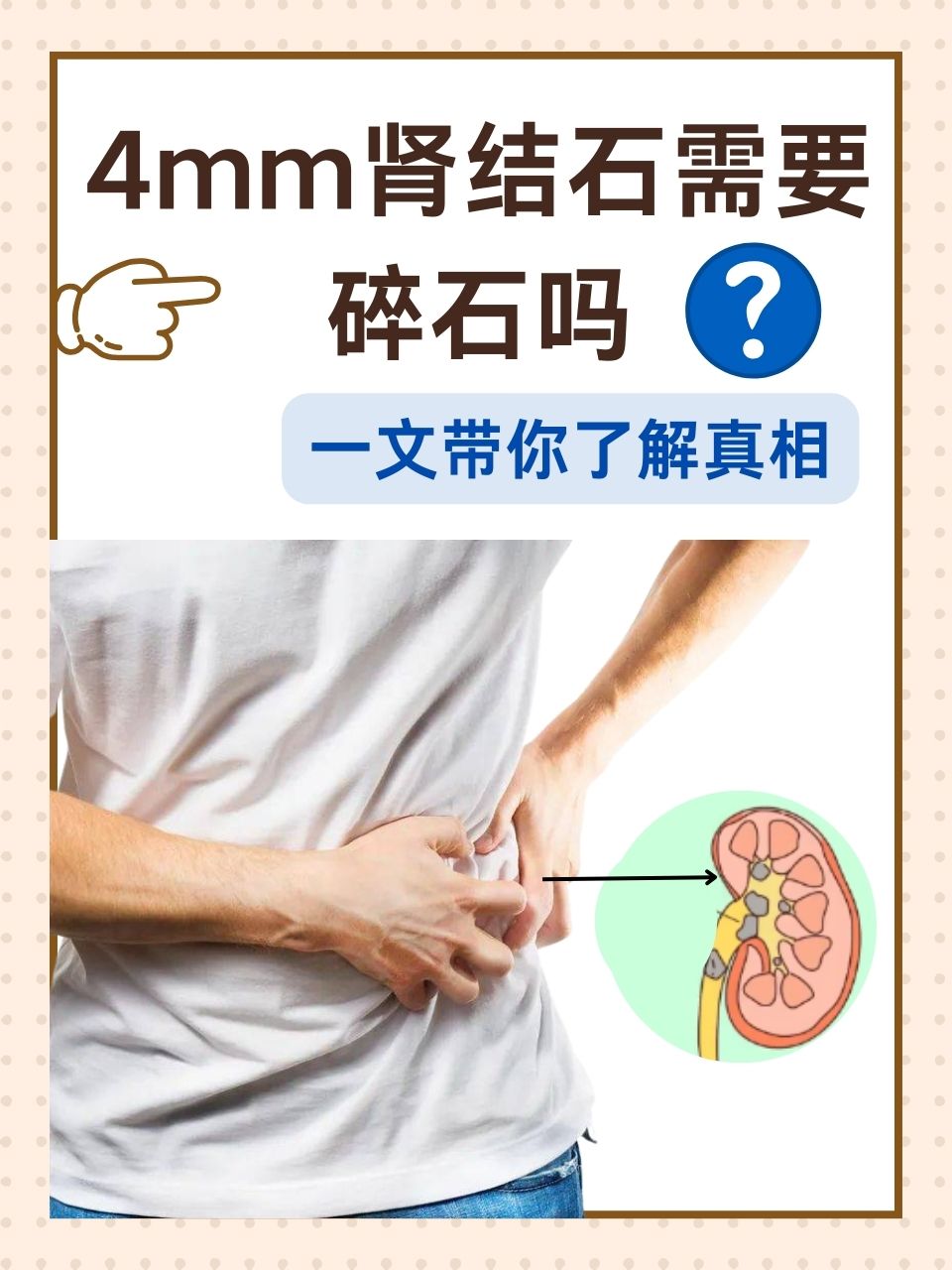 少一个肾会怎么样-一个肾正常能活多久
