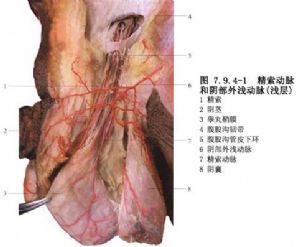 睾丸切除术-腹腔镜下睾丸切除术