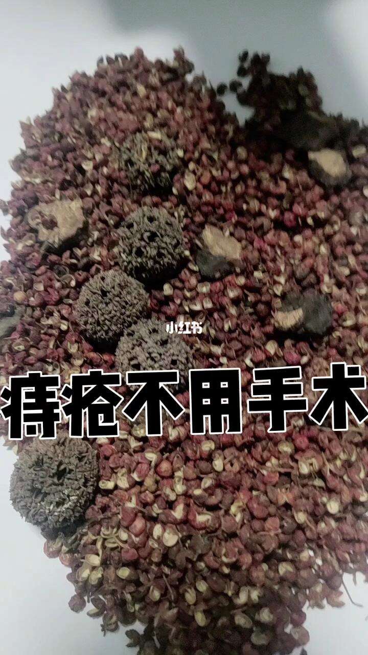 治痔疮土方-治痔疮土方法断根最快方法