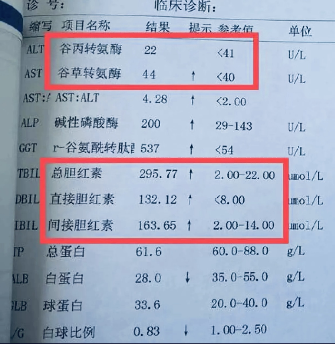 谷丙转氨酶正常值(血清谷丙转氨酶正常值)