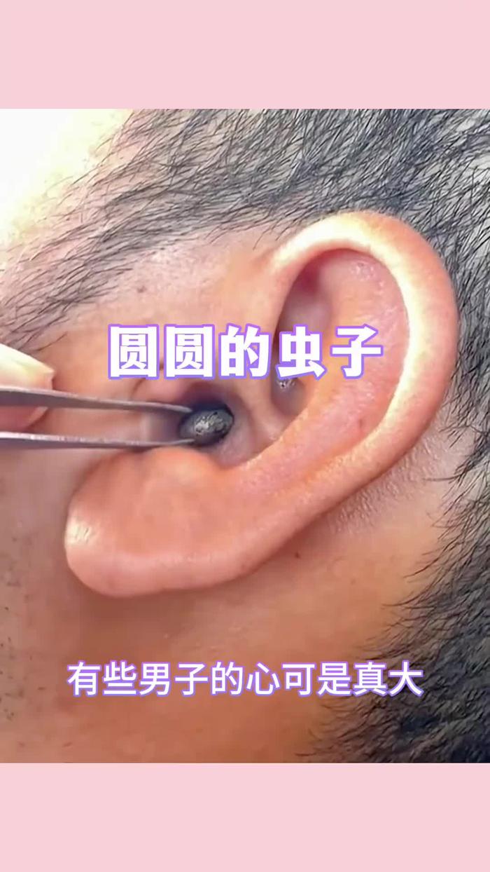 耳朵进虫子怎么办_(耳朵进虫子怎么办急救方法)
