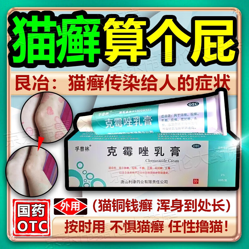 股癣用什么药_(股癣用什么药膏效果好,能除根)